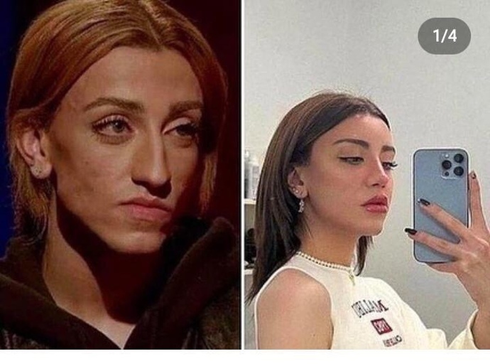 İnsanlar nasıl bu kadar ciltlerini güzelleştiriyor?
