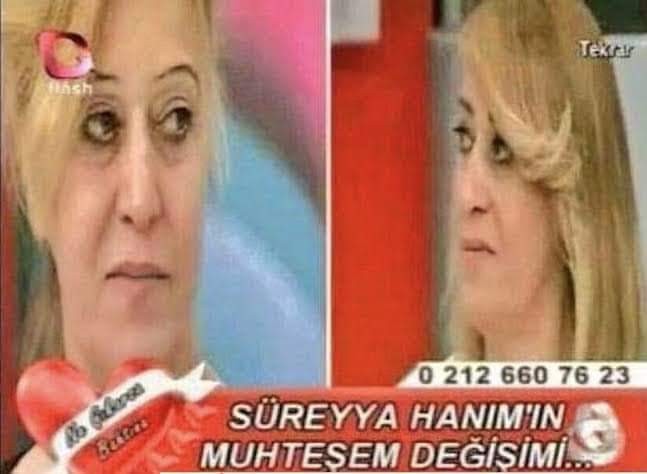 Türkiyede güzelleşme proqramları var mı?
