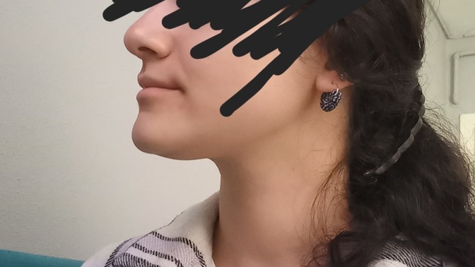 Çene hatlarım için jawline topu işe yarar mı?