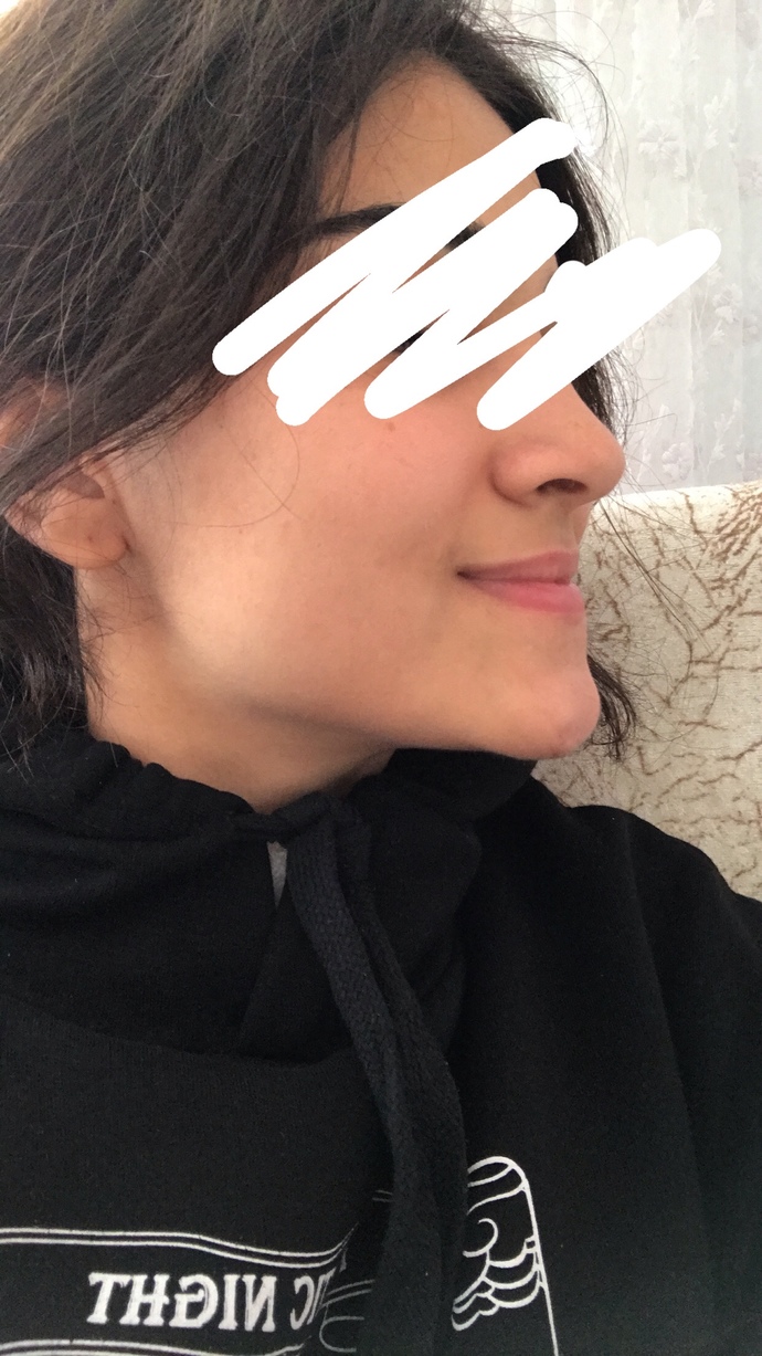 Çene hatlarım çok belirgin diye dalga geçiyorlar, sizce çok mu kötü?