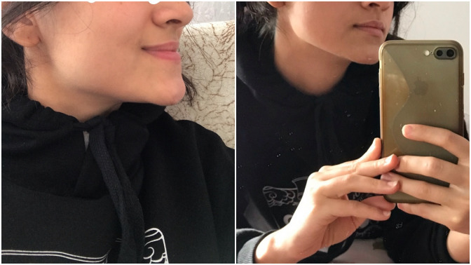 Çene hatlarım çok belirgin diye dalga geçiyorlar, sizce çok mu kötü?