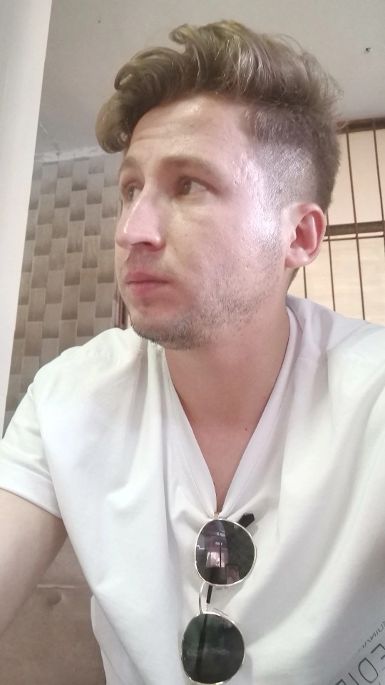 Takıntı haline getirdiğim burun ameliyatından 1 ay sonrası, sizce iyi olmuş mu?