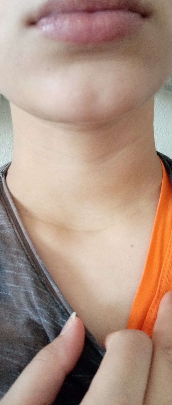 Boynum çok çirkin, kırışıklıklar nasıl geçer?