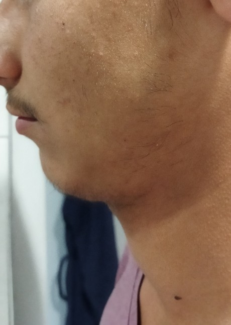 Bu sakal kendini toplar mı ya da  toplaması için ne yapmalıyım?