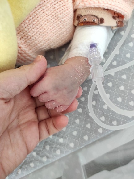 Yenidoğanda kalpte üfürüm ve sol böbrek büyümesi kendiliğinden düzelecek sorunlar mı 🥺?