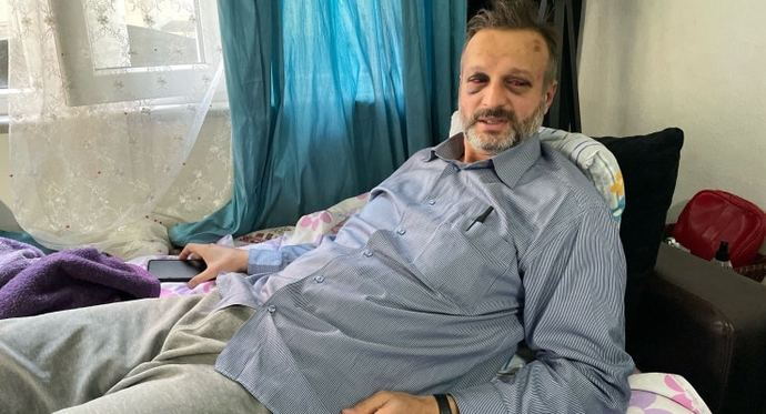 İstek parça’ çalmayan müzisyenin kaburgasını kırdılar. Sizce insanların bu öfkesi neden var?