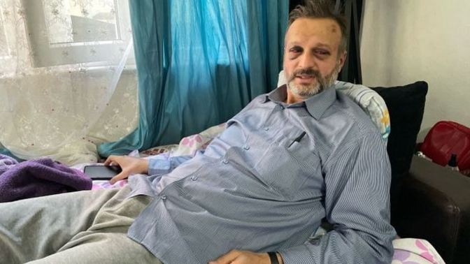 'İstek parça’ çalmayan müzisyenin kaburgasını kırdılar. Sizce insanların bu öfkesi neden var?