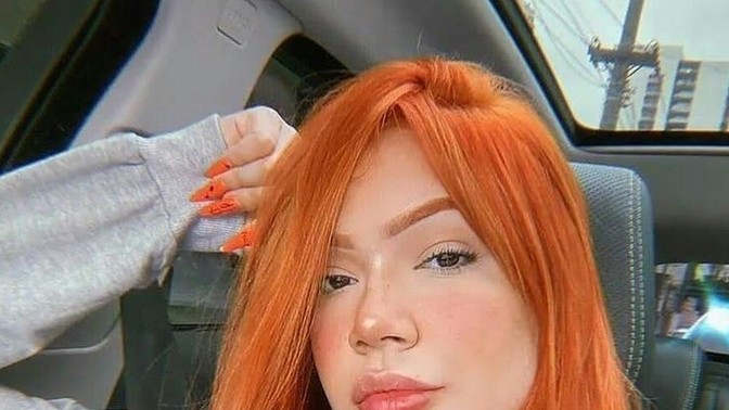 Dökülen saçların tek çaresi saç ektirmek mi?