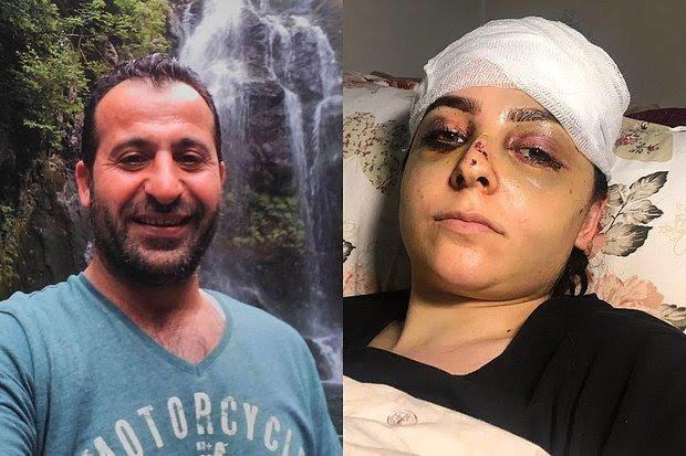 Bir adam tayt giydiği için karısını dövdü, tutuklanıp cezaevine atıldı! Sizce evlenince tayt giymek doğru mu?