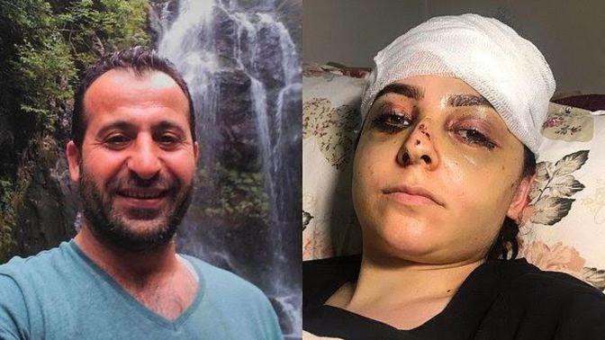 Bir adam tayt giydiği için karısını dövdü, tutuklanıp cezaevine atıldı! Sizce evlenince tayt giymek doğru mu?