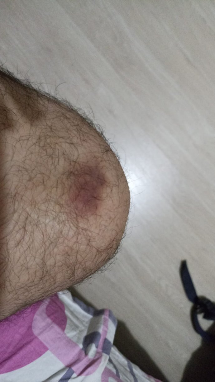 Eşim her sinirlendiğinde bana vuruyor. Dizim hep morluk içinde. Sizce boşanmalı mıyım? Psikiyatriye git dedim diye yapıyor?