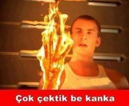 Yeter artık ellerim nasır tuttu!?