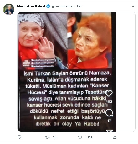 Ülkemizdeki insanların göbekli olması ekonomik krizin olmadığına dair bir zenginlik göstergesi midir?