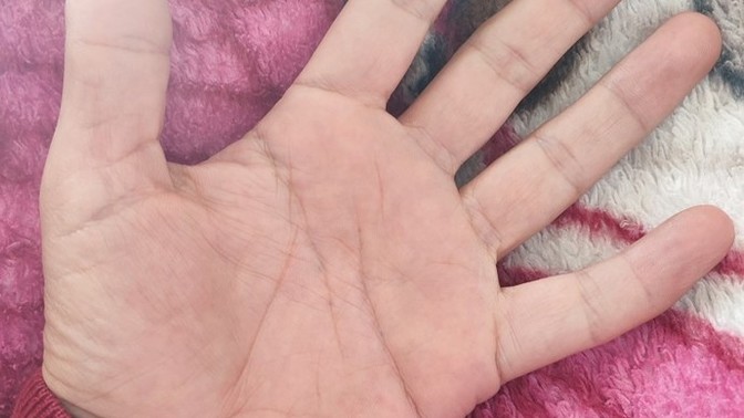 Grip olan birine bir meyve verseydiniz bu bu ne olurdu?