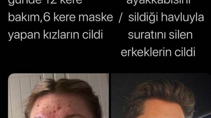 Çıkan sivilceyi sıkmak caiz mi?