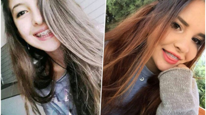 Dişlerinde tel olan insanlar ile dalga geçer misiniz?