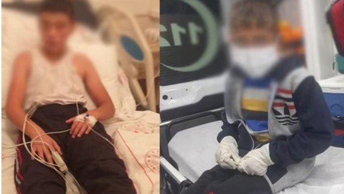 Bitlis'te köpeğin ısırdığı iki çocuktan biri kuduz oldu, sokak köpekleri toplanmalı mı?