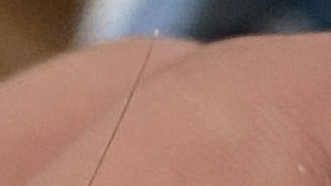 Saç kökünün beyaz olması normal mi?