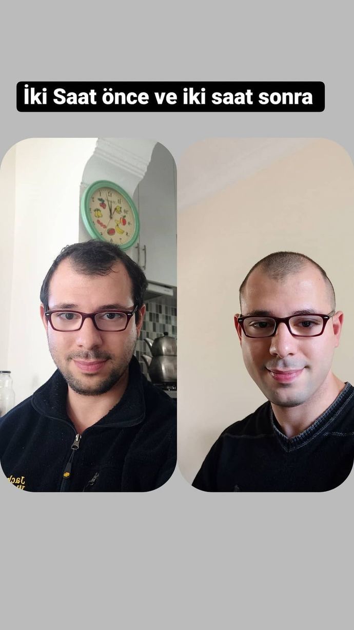 Kısa saç daha fazla yakışmıyor mu?