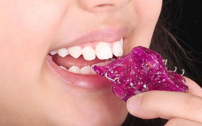 Diş teli ve damaklık tedavisi gören var mı?