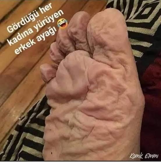 Ayakları bakımsız olan biri her konuda mı bakımsızdır?