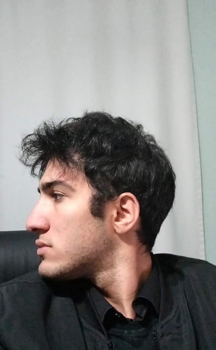 Sizce burnum büyük mü, estetik olmama gerek var mı?