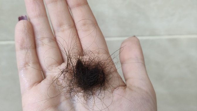 Her banyo sonrası saçlarım dökülüyor, nasıl engellerim?