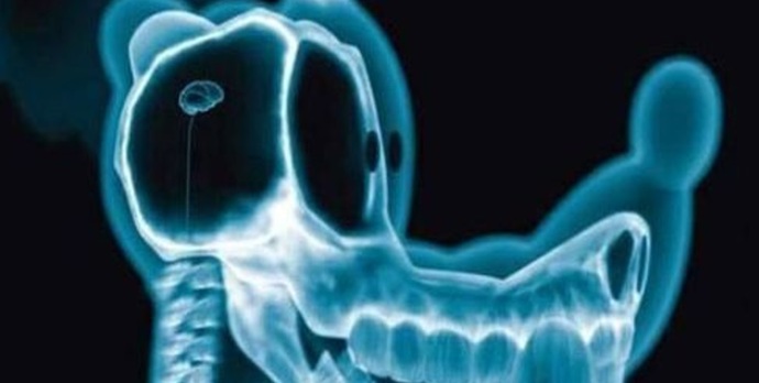 Çekilen röntgeni beğenmedi, doktoru darp etti! Sizce röntgen çektirmek sağlığa zararlı mı?