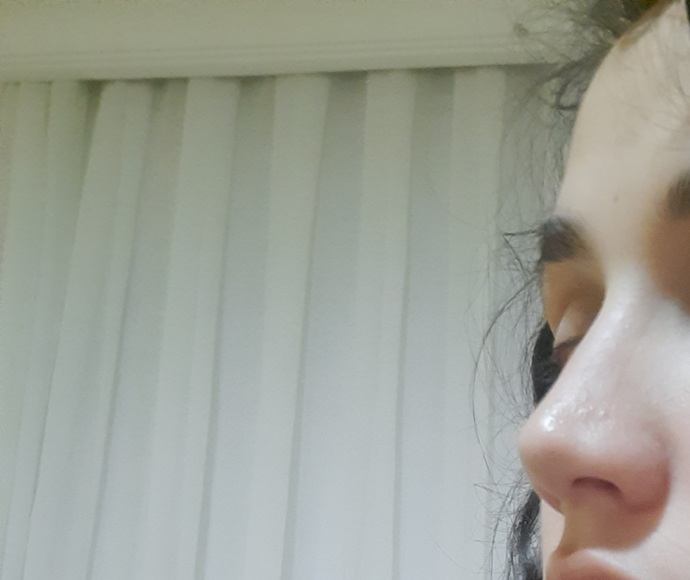 Bu burun guzel mi arkadaşlar?