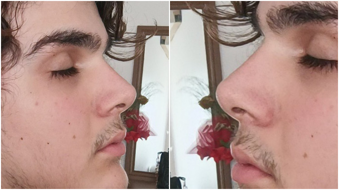 Burnumun estetiksiz hali sizce güzel mi?