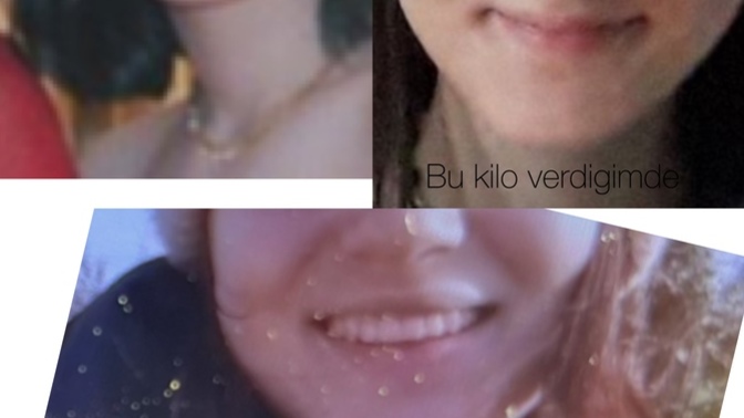 Kilo verdiğimde yanaklarım çok çirkinleşiyor ama kilo vermek istiyorum, ne yapabilirim?