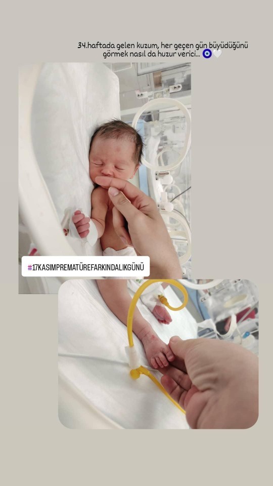 17 Kasım Prematüre Farkındalık Günümüz kutlu olsun mu o halde 🎗️🤍?