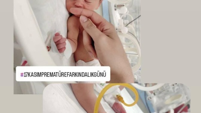 17 Kasım Prematüre Farkındalık Günümüz kutlu olsun mu o halde 🎗️🤍?