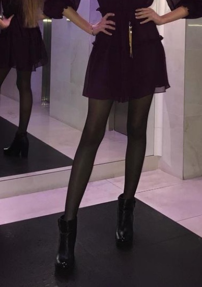 Bu etek boyutu normal mi kısa mı sizce?