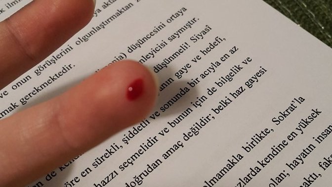 Kağıt kesiğinden daha çok acıtan ne var?