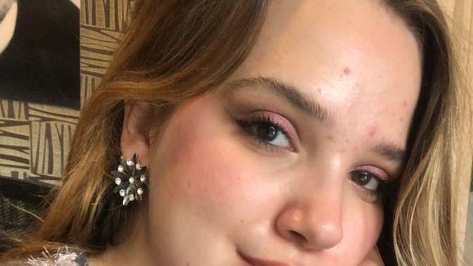Yüzümde sivilceler geçmiyor, ne yapmam lazım ya?