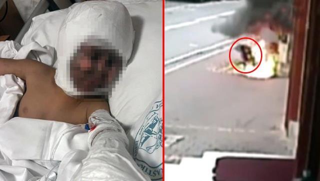 Elektrik trafosuna çatal sokan çocuk ağır yaralandı! Sizce bu olayın sorumlusu kim?