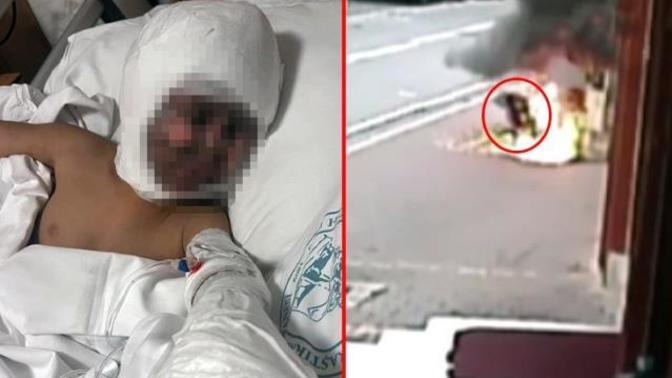 Elektrik trafosuna çatal sokan çocuk ağır yaralandı! Sizce bu olayın sorumlusu kim?