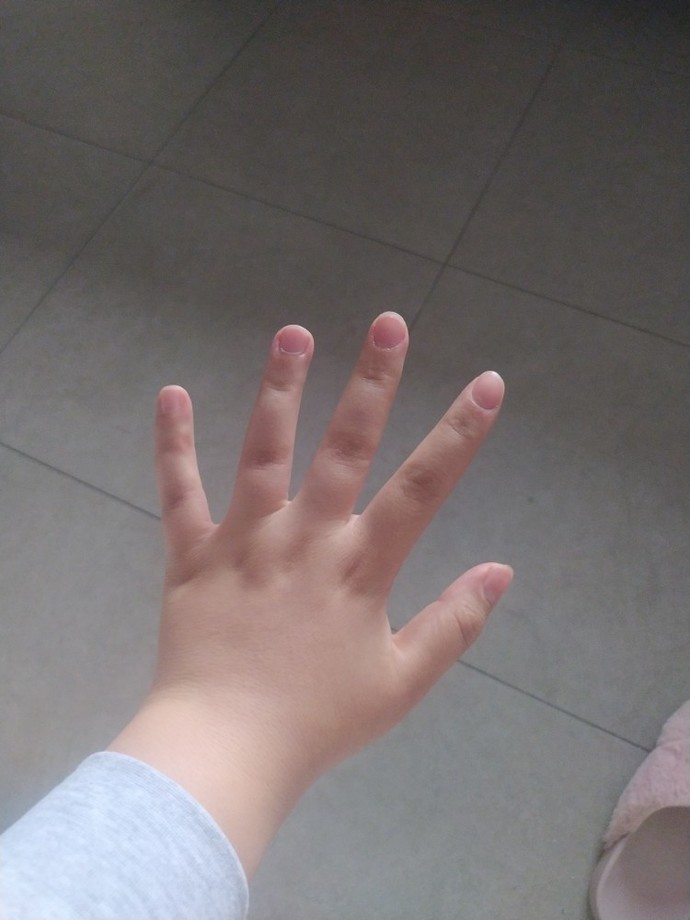 10-15 kilo versem bu el zayıflar mı :(?