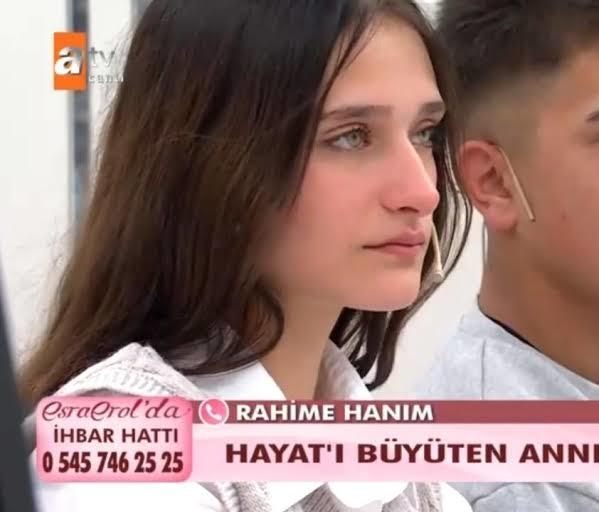 Burun, güzelliği çok etkiliyor mu?