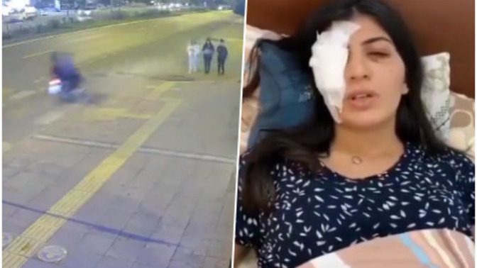 3 üniversiteli kız yolda yürürken, tanımadıkları motorlu 2 kişi bir şey fırlatmış. Bunlara ne ceza verilmeli?