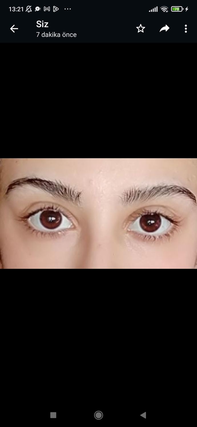 Kirpik batması ya da çapaklanma yaşıyor musunuz?