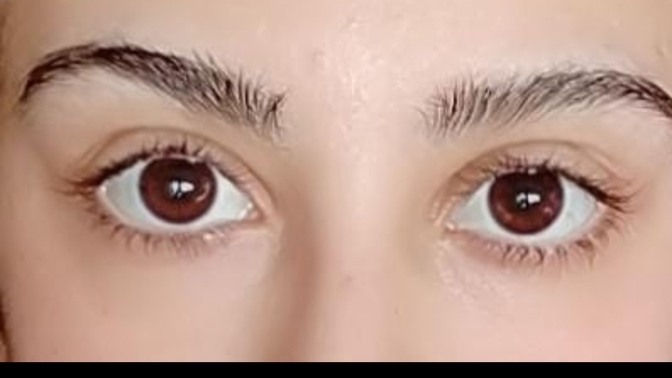 Kirpik batması ya da çapaklanma yaşıyor musunuz?
