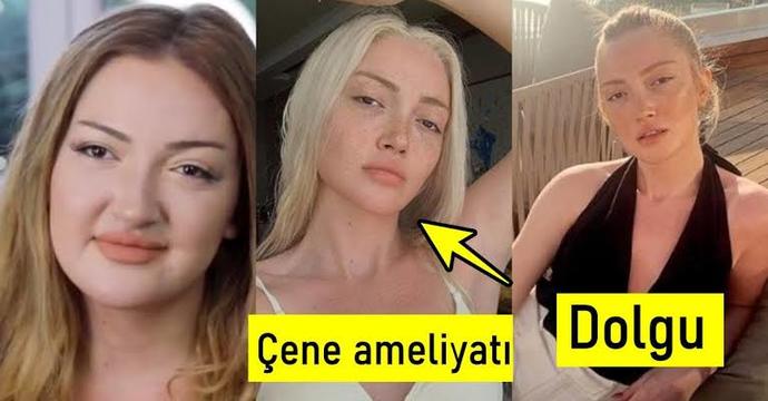 Estetikle çok güzel olunur mu?
