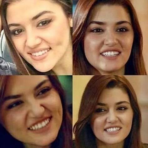 Dışarda insanlara baktığınız da kimin doğal kimin estetikli olduğunu anlayabiliyor musunuz?