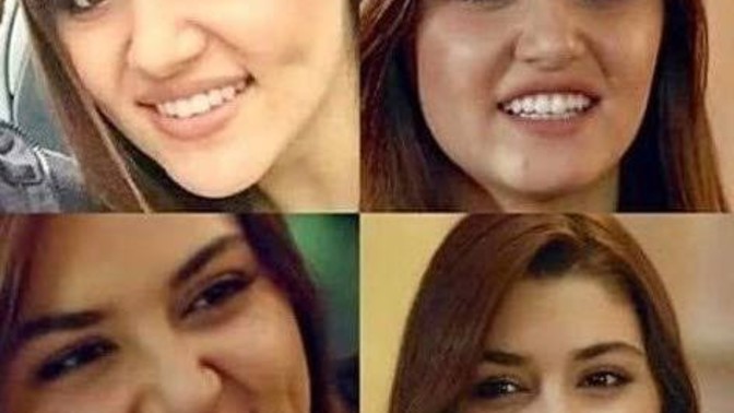 Dışarda insanlara baktığınız da kimin doğal kimin estetikli olduğunu anlayabiliyor musunuz?