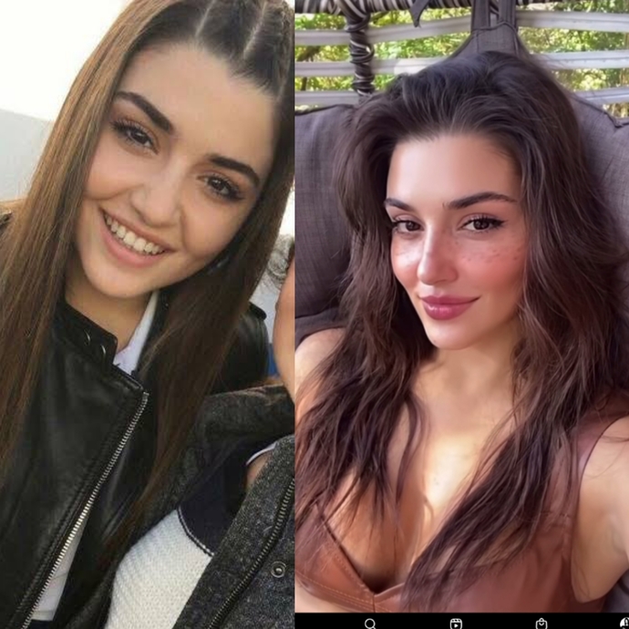 29 yaşına basan Hande Erçel estetiğim yok diyor, Ünlüler neden estetikli olduğunu kabul etmez sizce?