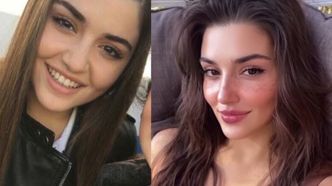 29 yaşına basan Hande Erçel estetiğim yok diyor, Ünlüler neden estetikli olduğunu kabul etmez sizce?