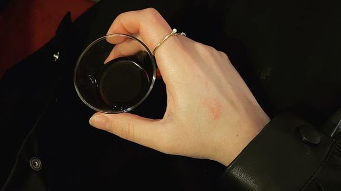 Gün içinde sakarlıklarınız olur mu bazen komik bazen utandırıcı?