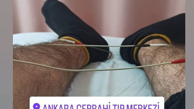 Fizik tedavi alıyor musunuz?